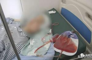 The diameter discovers inside skull 7 centimeters eyewinker, bring about disposition to change great